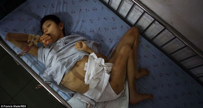 Báo Anh: "Nỗi đau da cam" ở VN khiến tim bạn "tan chảy" - 4