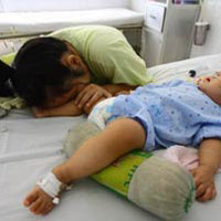 Sức khỏe đời sống - Nguy cơ bùng phát bệnh tay chân miệng