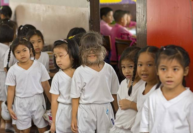 Dù thường&nbsp;bị bạn bè trêu chọc là “con khỉ” hay “người sói”, cô bé 11 tuổi này vẫn cảm thấy rất vui vẻ bởi nó đã giúp Supatra&nbsp;có tên trong cuốn sách kỷ lục Guinness - Cô gái nhiều lông nhất thế giới.
