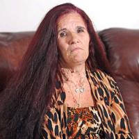 Sức khỏe đời sống - Bác sĩ để quên ống nhựa trong cơ thể bệnh nhân