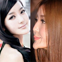 Thẩm mỹ viện - 5 người đẹp mất xinh vì dao kéo quá tay