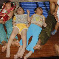 Sức khỏe đời sống - Chưa ghi nhận ca nhiễm virus bại liệt tại Việt Nam