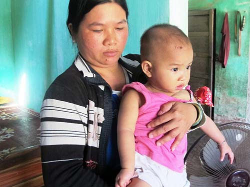 Đỡ ngược khi sinh, bé gái liệt tay - 1