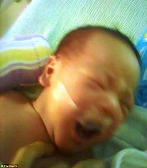 Philippines: Y tá bịt miệng trẻ bằng băng dính - 3