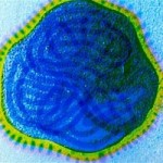 Sức khỏe đời sống - Trị ung thư bằng virus sởi