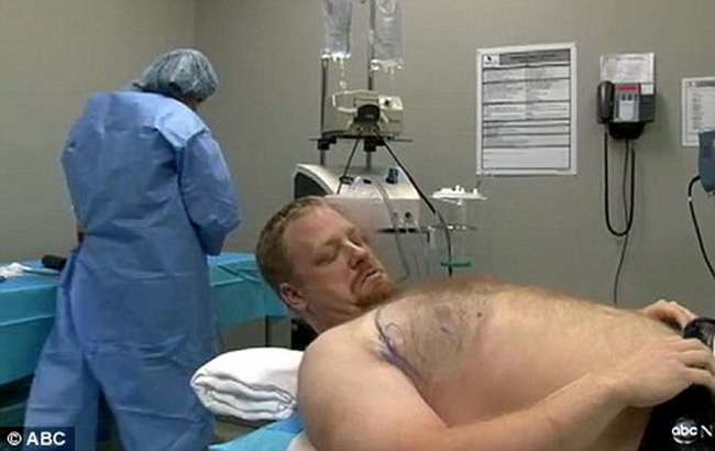Sau ca phẫu thuật kéo dài 1 tiếng, ngực của Erik đã giảm đáng kể.
