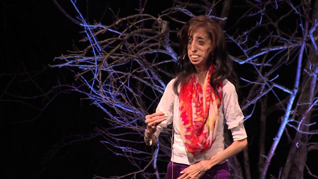 Năm 2012, đoạn Youtube về hình ảnh của Lizzie Velasquez bị đăng tải trên mạng với tiêu đề "Người nữ nữ xấu xí nhất thế giới". Đối diện với những lời bình luận ác ý về ngoại hình của mình, thay vì bi quan, Lizzie đã mạnh mẽ đứng lên và trở thành nguồn động viên lớn cho nhiều người.
