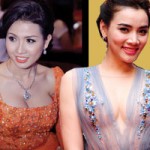 Thẩm mỹ viện - Những vòng 1 &quot;gáo dừa&quot; trong showbiz Việt