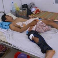 Tin tức trong ngày - Ngư dân bị tàu lạ đâm chìm đã qua cơn nguy kịch