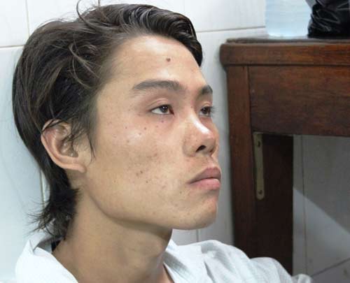 Trinh sát nổ súng bắt hai tên cướp - 2