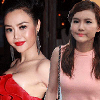 Thẩm mỹ viện - Những khuôn mặt "nặng nề" của mỹ nhân Á