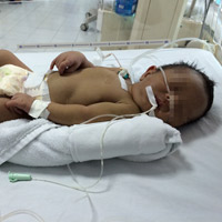 Sức khỏe đời sống - Bé sơ sinh vàng da do bất đồng nhóm máu với mẹ