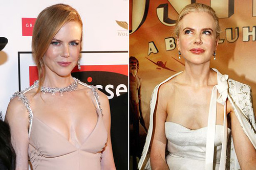 “Thiên Nga Úc” Nicole Kidman bất ngờ mặc hở táo bạo - 7