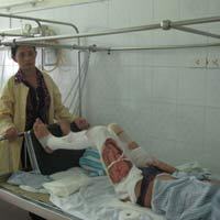 Sức khỏe đời sống - Nam sinh suýt bỏng 'của quý' vì nổ cồn nướng mực