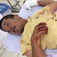 Pháp luật - Tp.HCM: Làm rõ vụ "chém người trước mặt công an"