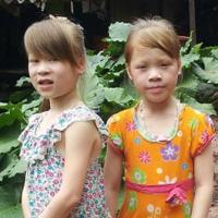 Tin tức trong ngày - Kỳ lạ cặp chị em “giống Tây” ở Cao Bằng