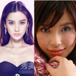 Thẩm mỹ viện - Angelababy đổi đời nhờ dao kéo