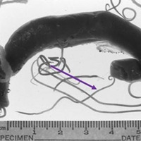 Sức khỏe đời sống - Cảnh báo viêm não do ấu trùng giun đũa chó mèo