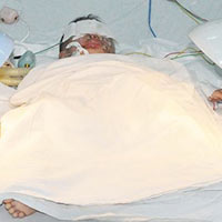 Sức khỏe đời sống - Nhiều bố mẹ “mù” sơ cứu tai nạn cho con trẻ