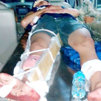 Pháp luật - Đề nghị truy tố ông bố đánh gãy chân người yêu con gái