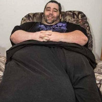 Sức khỏe đời sống - 7 năm không "quan hệ" vì tinh hoàn khủng