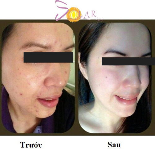 Làm trắng da mặt ấn tượng với siêu công nghệ - 3