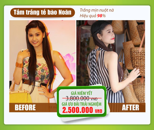 Viện thẩm mỹ Khơ Thị giảm sốc 40% các liệu trình - 2