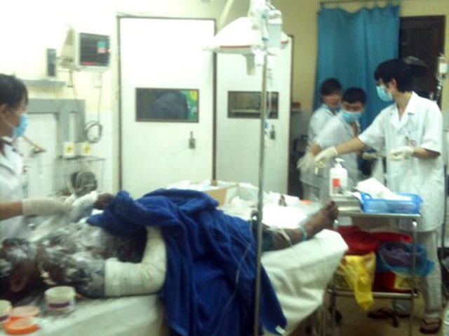 Quảng Ninh: 6 người bỏng nặng, dính đầy bụi than - 1