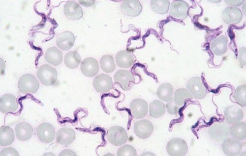 TPHCM: Người đầu tiên nhiễm trùng roi lạ - 1