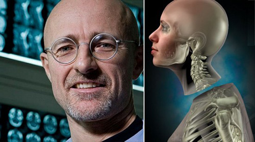 Sốc: Tình nguyện chặt đầu để được ghép đầu - 4