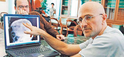 Sốc: Tình nguyện chặt đầu để được ghép đầu - 5