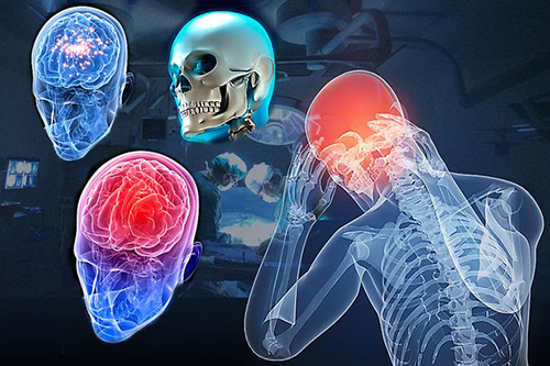 Sốc: Tình nguyện chặt đầu để được ghép đầu - 2