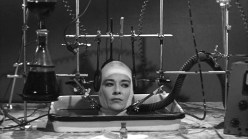 Sốc: Tình nguyện chặt đầu để được ghép đầu - 6