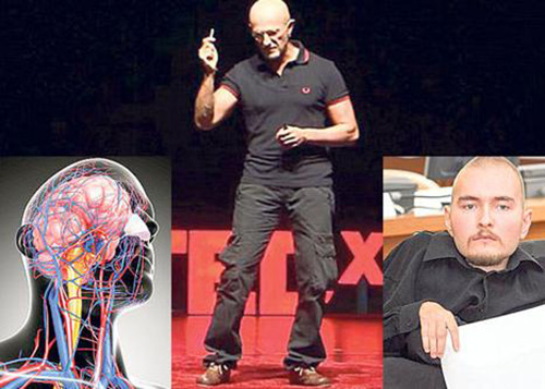 Sốc: Tình nguyện chặt đầu để được ghép đầu - 8