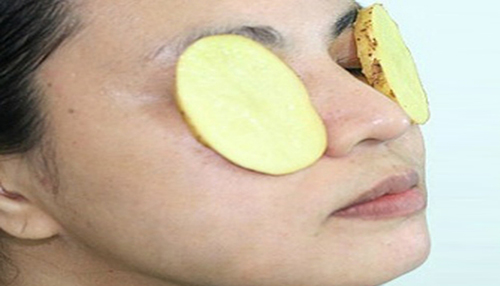 7 giải pháp tốt cho hiện tượng sưng bọng mắt - 3