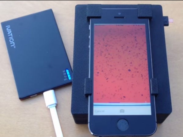 Điện thoại Iphone 5S phát hiện ký sinh trùng trong máu - 1