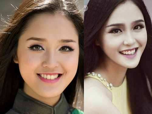 Hoài nghi trước cằm dài, nhọn bất thường của người đẹp Việt - 10