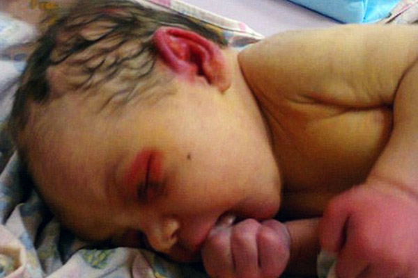 Đau lòng bé 3 ngày tuổi bị bỏ rơi làm mồi cho kiến - 1