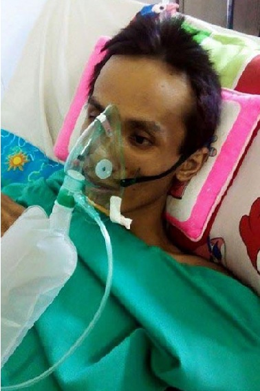 Bất ngờ với ca sỹ Việt có phổi bị hủy hoại 95% - 3