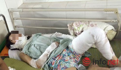 Nướng mực bằng cồn: Vợ thành ngọn đuốc sống - 1