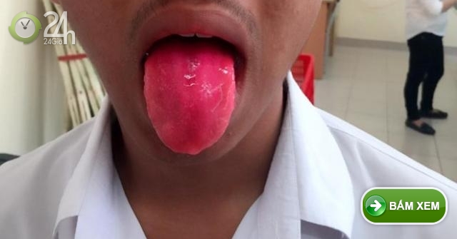 Ăn xong buồn nôn, khó chịu vẫn… ăn