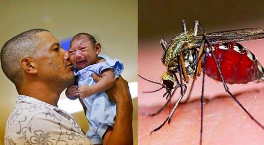 Thêm bằng chứng virus Zika liên quan bất thường não thai nhi - 1