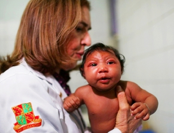 Thêm bằng chứng virus Zika liên quan bất thường não thai nhi - 3