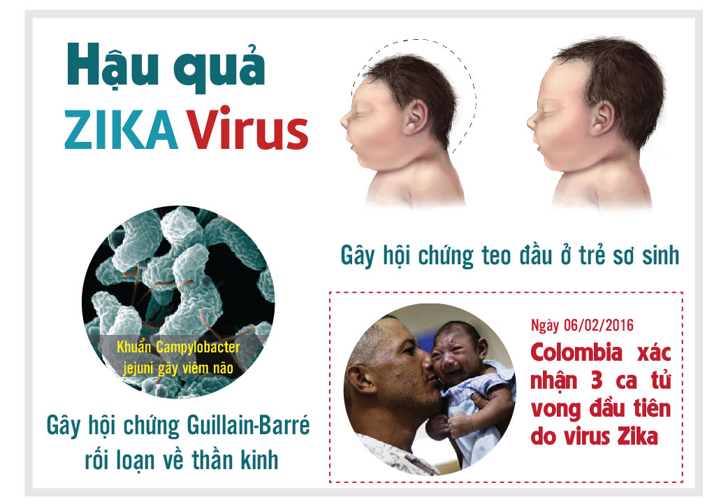 Trieu chung Virus Zika   cach phong tranh Virus Zika an nao nguoi  virut zika  vius zika o viet nam  benh truyen nhiem tu muoi  benh tu muoi  muoi dot  zika  suc khoe  suc khoe 24h  cham soc suc khoe  suc khoe gia dinh  suc khoe doi song  chua benh  cac loai benh  y te  tin tuc  tin tức virus zika mới nhất