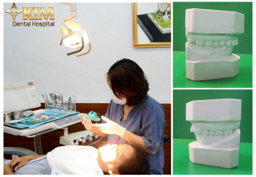 Sửa răng sứ đã bọc nhưng không đẹp - 4