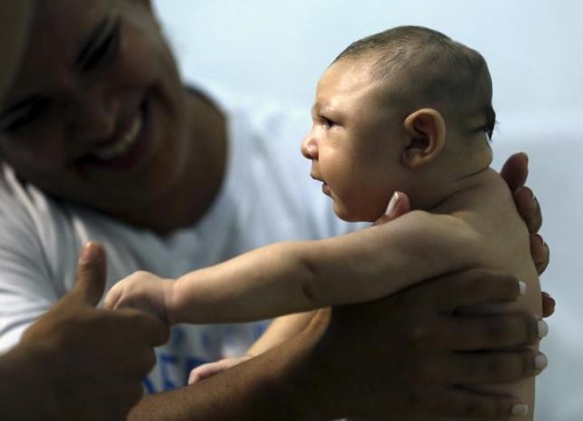 Bằng chứng virus Zika tấn công làm teo não trẻ sơ sinh - 1