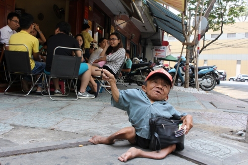 Chuyện đời đẫm nước mắt của người đàn bà chăm sóc “sọ dừa” - 2
