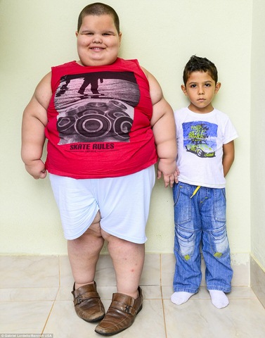 Brazil: Cậu bé 5 tuổi nặng 76kg - 1