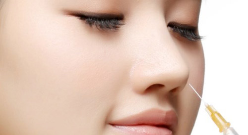 Giải mã ‘cơn sốt’ nâng mũi không phẫu thuật - 1