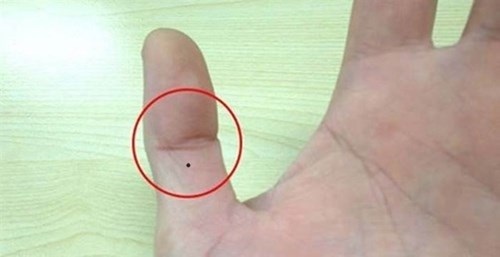 Giải mã tất tần tật về nốt ruồi trên ngón tay của bạn - 1